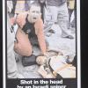 Shot in the head / by an Israeli sniper