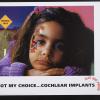 Not my choice..Cochlear Implants